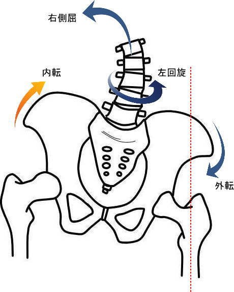 股関節荷重位側寛骨の外転